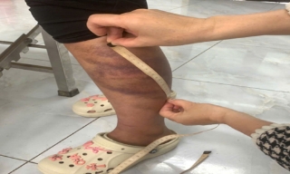 Tạm giữ người đàn ông nhiều lần bạo hành vợ đang mang thai và con gái 13 tuổi